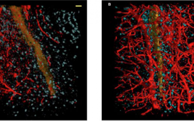 X-Ray Phase Contrast Tomography Reveals Early Vascular Alterations and Neuronal Loss in a Multiple Sclerosis Model