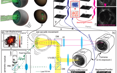 Stochastically structured illumination microscopy scan less super resolution imaging