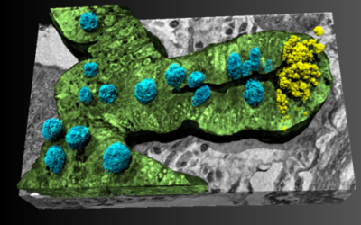 Rivelato il legame intestino-cervello nell’Alzheimer grazie ai raggi X